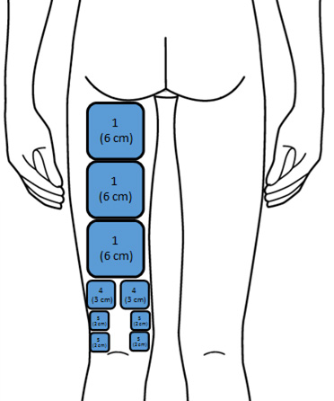 FB2-Hamstring-Matrix